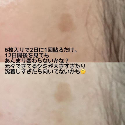 ディープビタCパッチ/MEDICUBE/その他スキンケアを使ったクチコミ(3枚目)