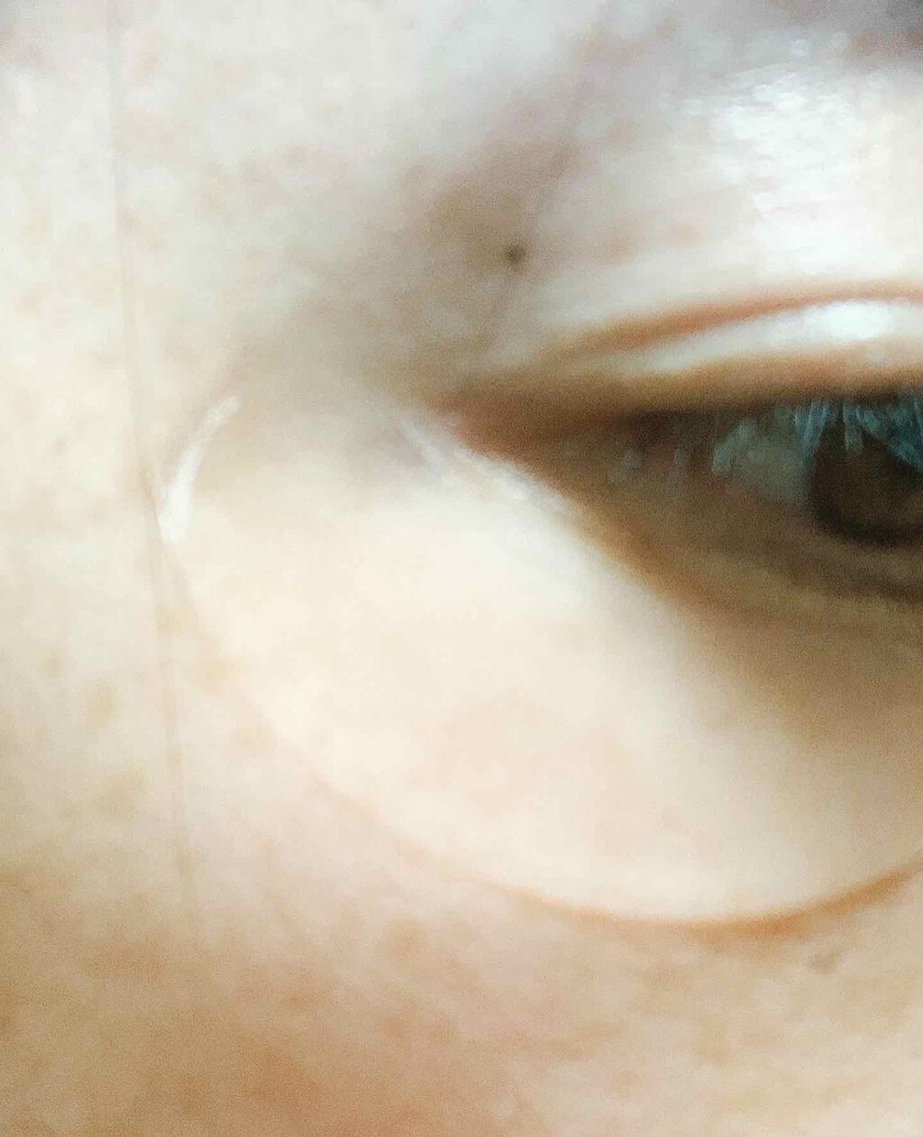 ダイレクトセンサーパッチ/∴M4/シートマスク・パックを使ったクチコミ(4枚目)