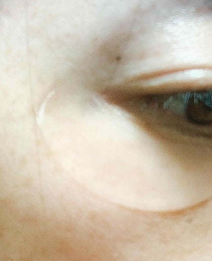 ダイレクトセンサーパッチ/∴M4/シートマスク・パックを使ったクチコミ(4枚目)