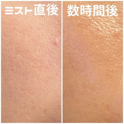 ãã©ããã£ãã¯ãã¹ã EX/ããã¢ãŒãžã¥/ãã¹ãç¶åç²§æ°Žã䜿ã£ãã¯ãã³ãïŒ7æç®ïŒ