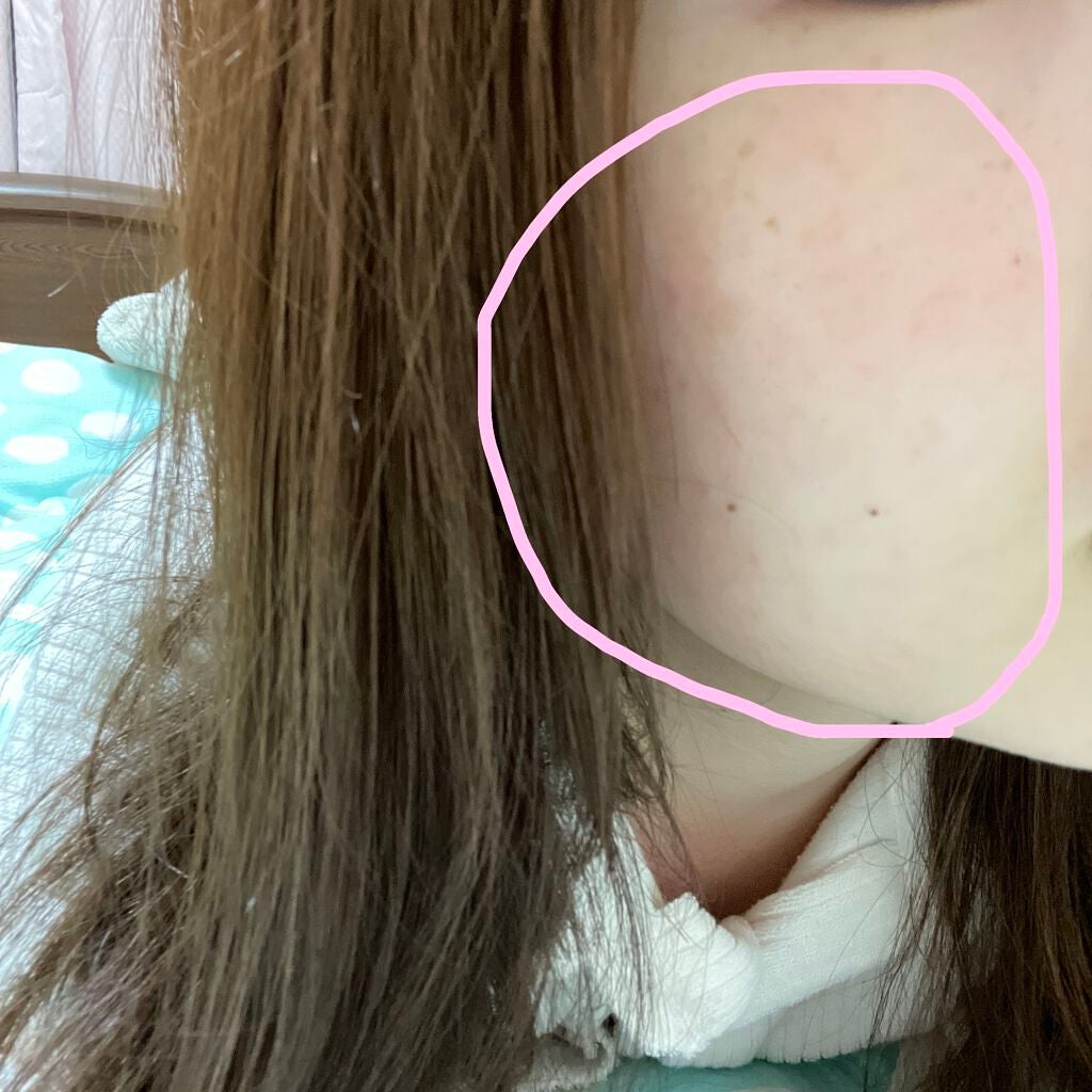 スンジョン トナー/ETUDE/化粧水を使ったクチコミ(2枚目)