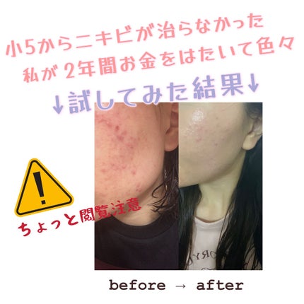 マイルド&モイスチャーアロエジェル/ネイチャーリパブリック/ボディローションを使ったクチコミ(1枚目)