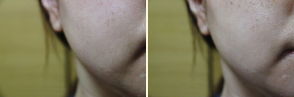 ゴールド ペプチド ブースティング アンプル/FEDORA AESTHETIC/美容液を使ったクチコミ(3枚目)