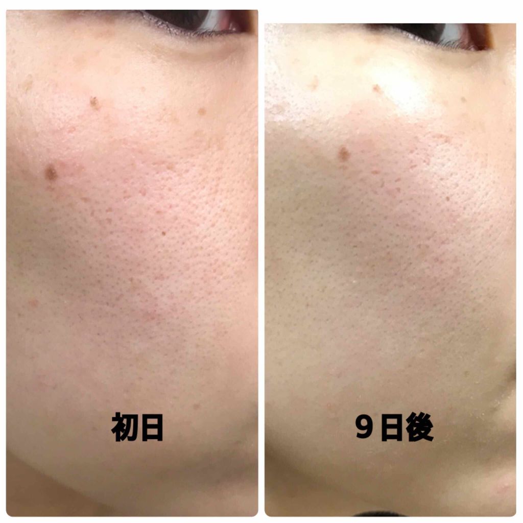 エリクシール エリクシール ルフレ バランシング スキンケアセットのクチコミ「エリクシール ルフレ
トライアルセット使い切りました👏


🙇‍♂️語彙力低めはご了承ください.....」（3枚目）