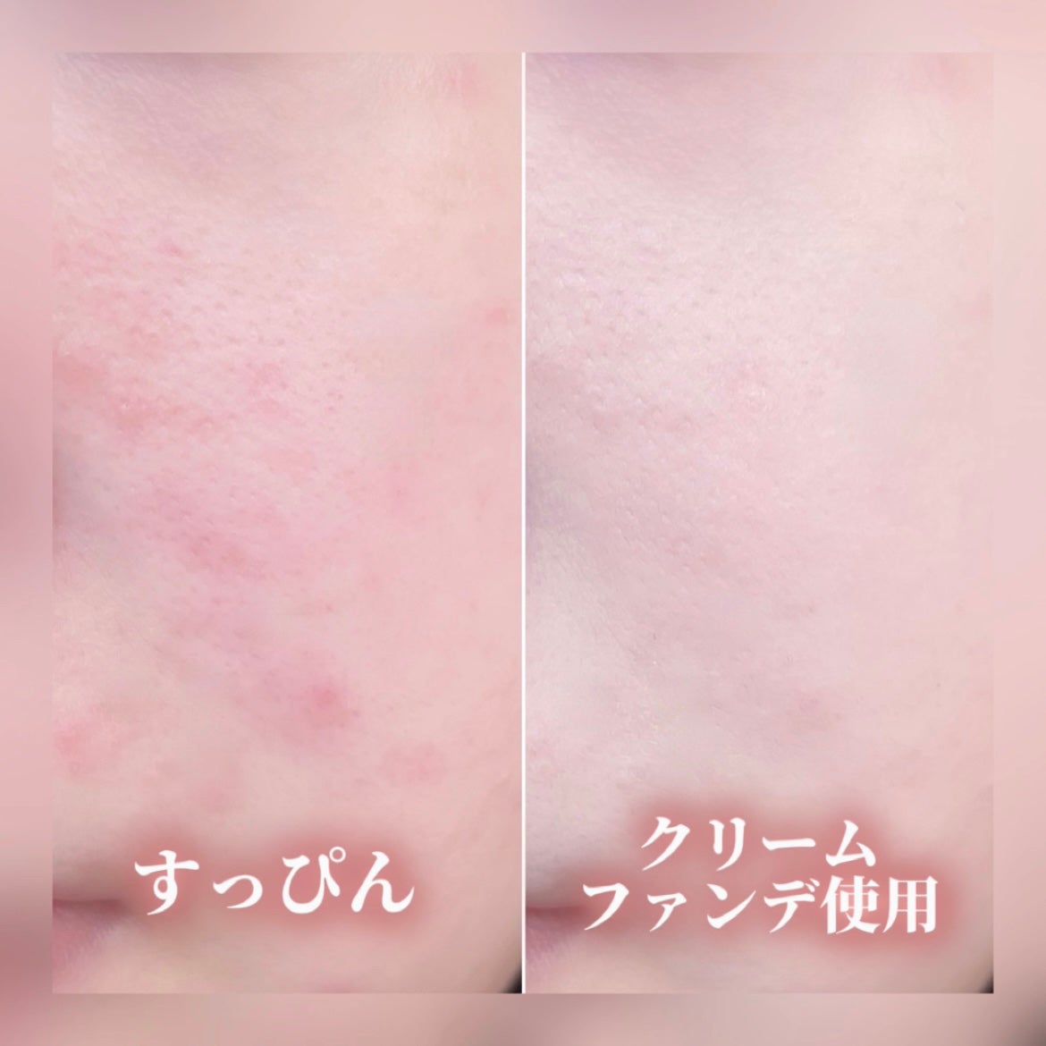 マーシュフィールド SC クリームファンデI(インナーカラー)/マーシュ・フィールド/クリーム・エマルジョンファンデーションを使ったクチコミ(5枚目)