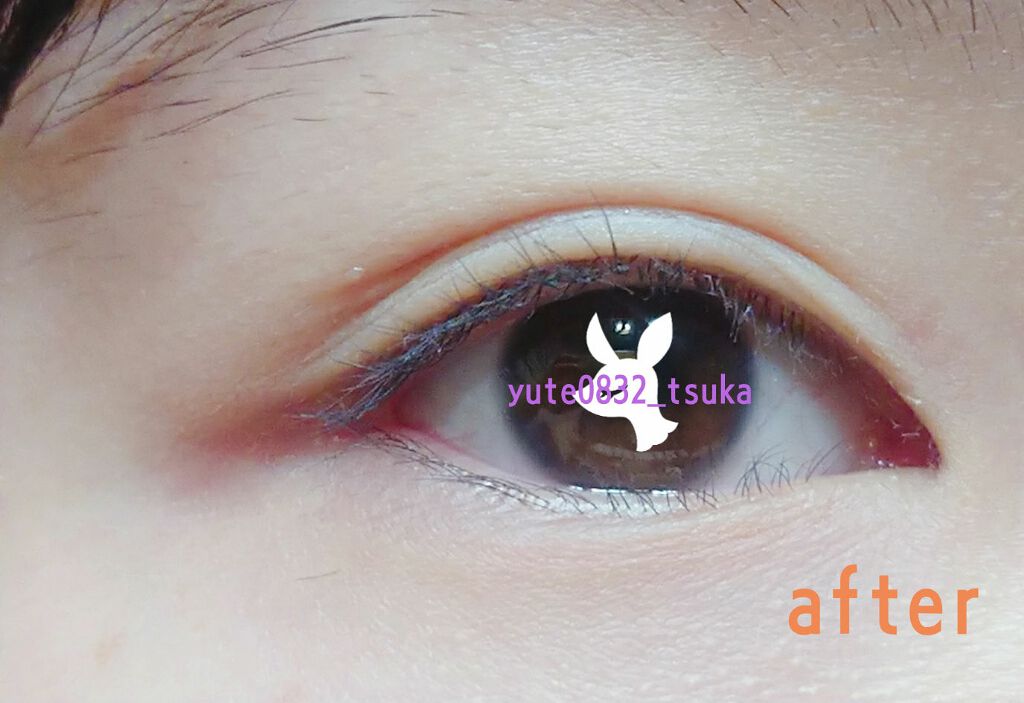 アイビューティー フィクサー WP/アストレア ヴィルゴ/二重まぶた用アイテムを使ったクチコミ（2枚目）