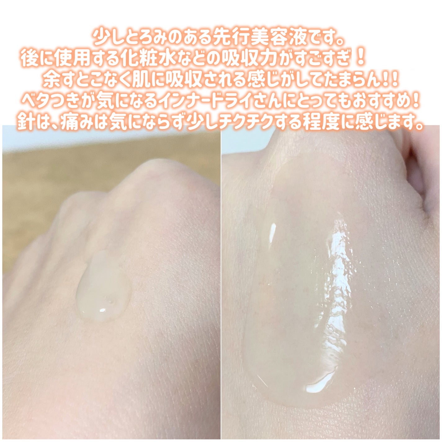 NDSポイントショット2000アンプル/ISOI/美容液を使ったクチコミ(3枚目)