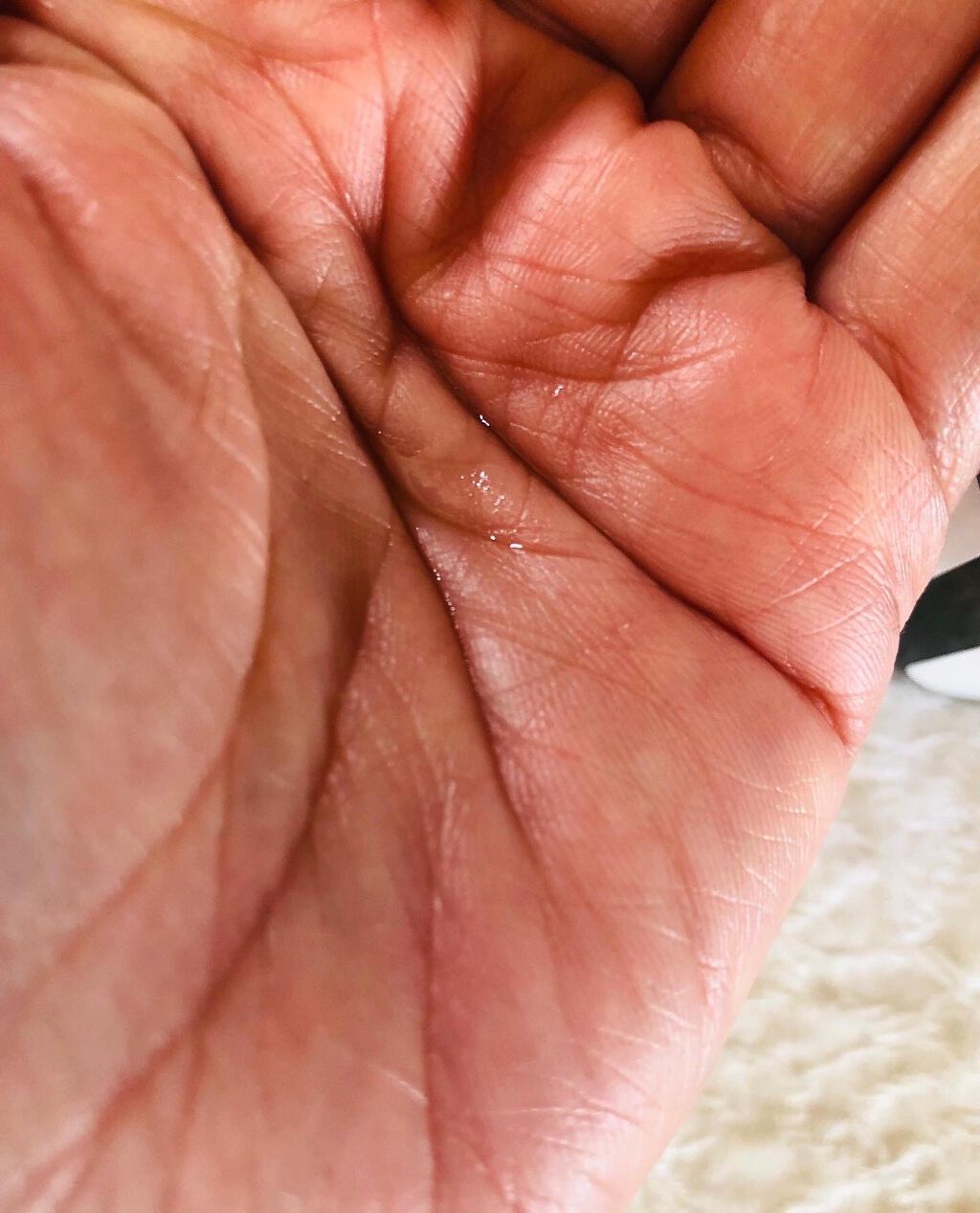 タカミエッセンスCE/タカミ/美容液を使ったクチコミ（3枚目）