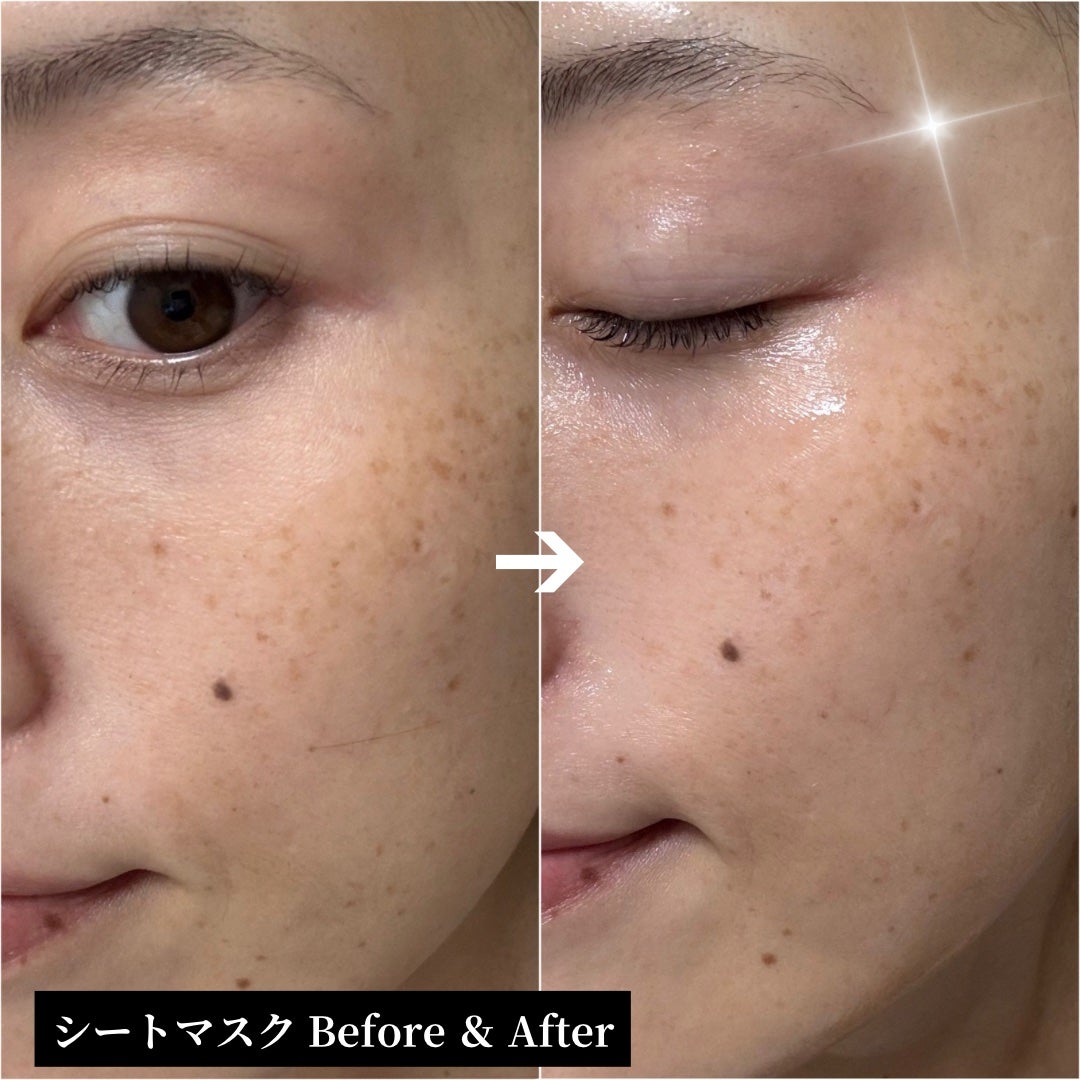 超低分子シートマスク/Isntree/シートマスク・パックを使ったクチコミ(8枚目)