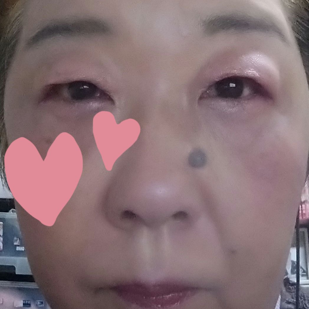 アンドバイロムアンド　グラッシーボムティント/&nd by rom&nd/リップティントを使ったクチコミ（3枚目）