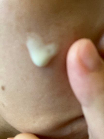 レチノールインテンスリアクティベーションセラム/SOME BY MI/美容液を使ったクチコミ(3枚目)