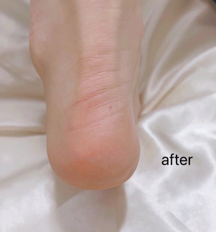 シルキーココナッツオイルフットマスク /MADFORCOS/レッグ・フットケアを使ったクチコミ(9枚目)