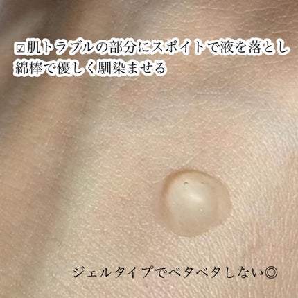 アクニドクターファーストスピーディースポット/ISOI/美容液を使ったクチコミ(5枚目)