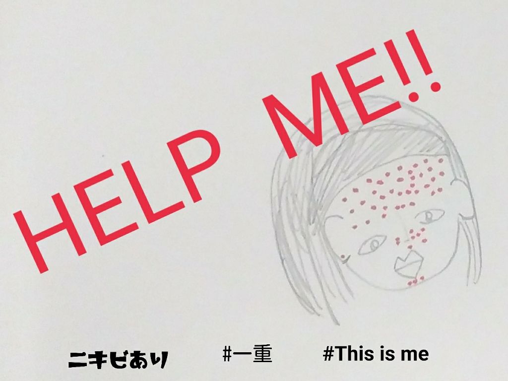 薬用アクネコントロール フレッシュ ローション/DHC/化粧水を使ったクチコミ（1枚目）