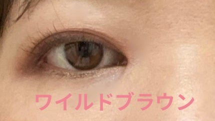 【旧】ディオールスキン フォーエヴァー スキン コレクト コンシーラー/Dior/リキッドコンシーラーを使ったクチコミ(2枚目)