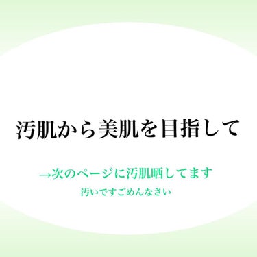 オルビス ユードット ローション/オルビス/化粧水を使ったクチコミ（1枚目）