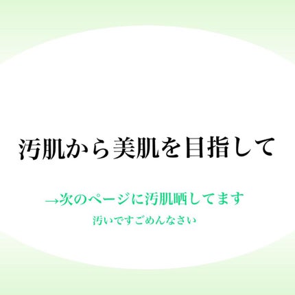 オルビス ユードット ローション/オルビス/化粧水を使ったクチコミ(1枚目)