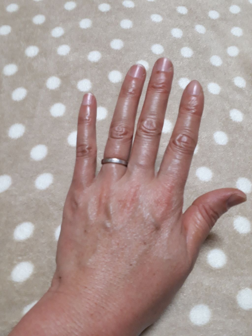 ディープセラム/Dr.Nail/ネイルオイル・トリートメントを使ったクチコミ(2枚目)