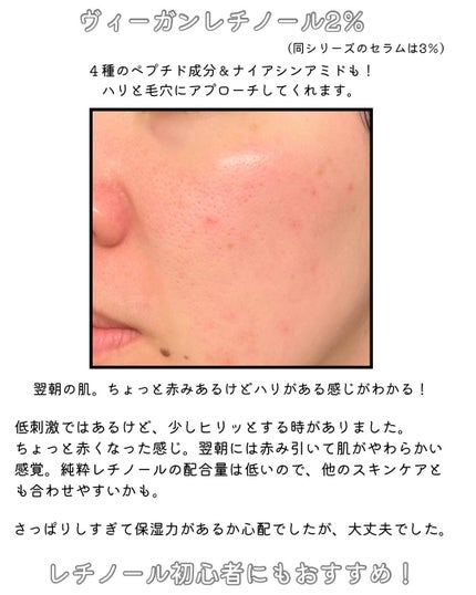 レチノールリフティングローラークリーム/SKIN&LAB/フェイスクリームを使ったクチコミ(5枚目)