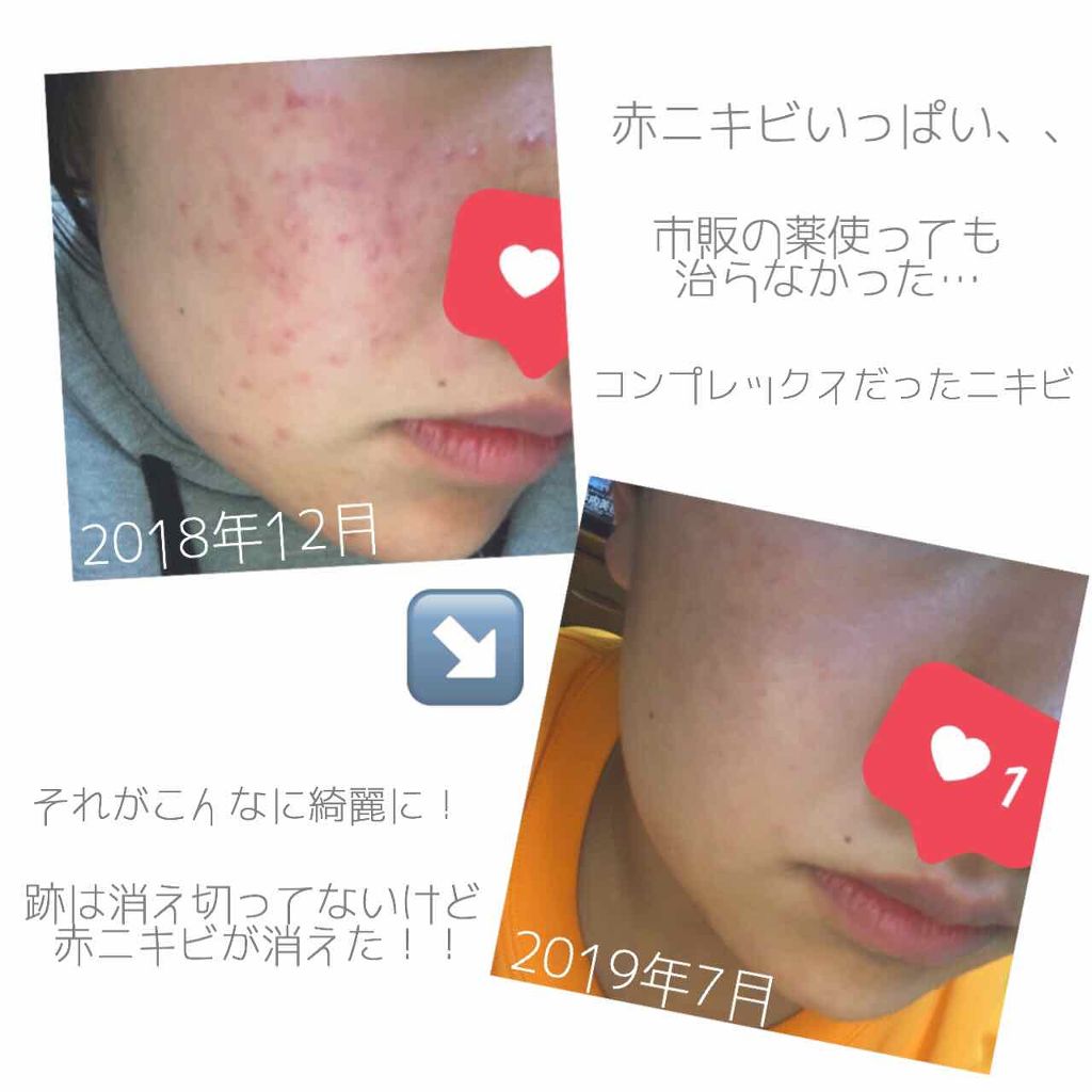 ハトムギ化粧水(ナチュリエ スキンコンディショナー R )/ナチュリエ/化粧水を使ったクチコミ（2枚目）