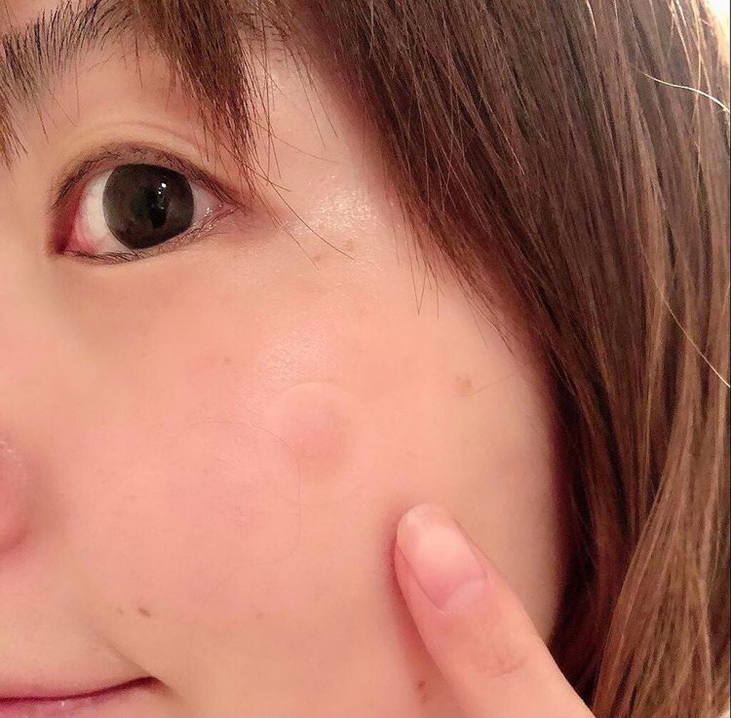 ビタC ディープパッチ/シミウス/シートマスク・パックを使ったクチコミ(2枚目)