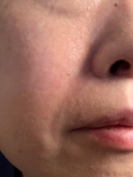 ピンクティーツリーカバーアップグロウクッション/APLIN/クッションファンデーションを使ったクチコミ(6枚目)