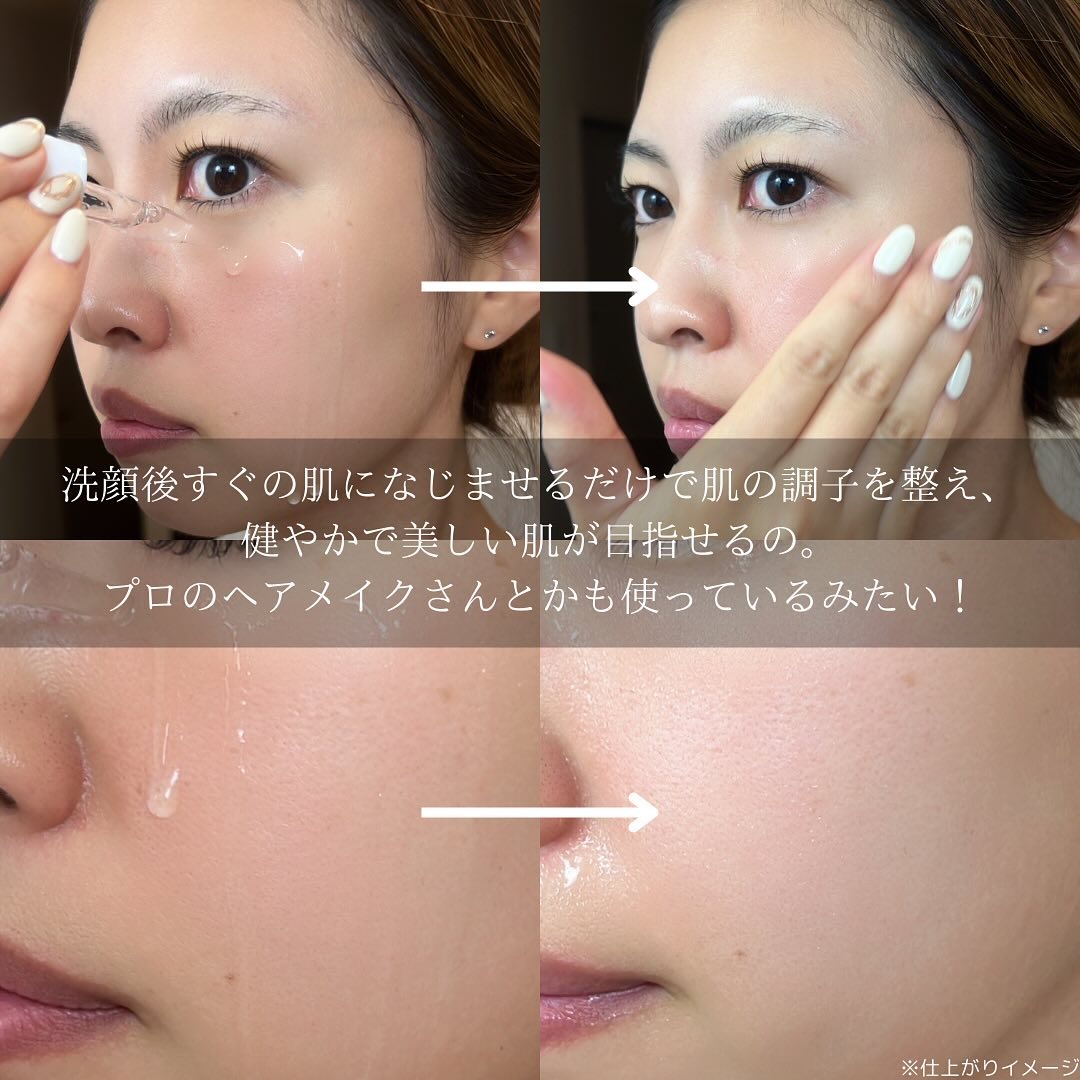 ファイン100/imini/美容液を使ったクチコミ（3枚目）