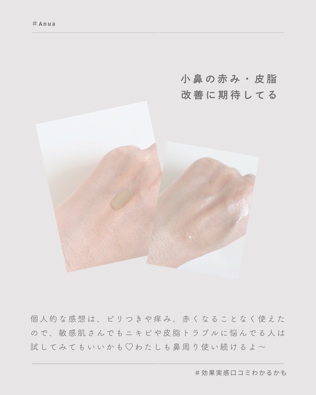 アゼライン酸15 インテンスカーミングセラム/Anua/美容液を使ったクチコミ(7枚目)