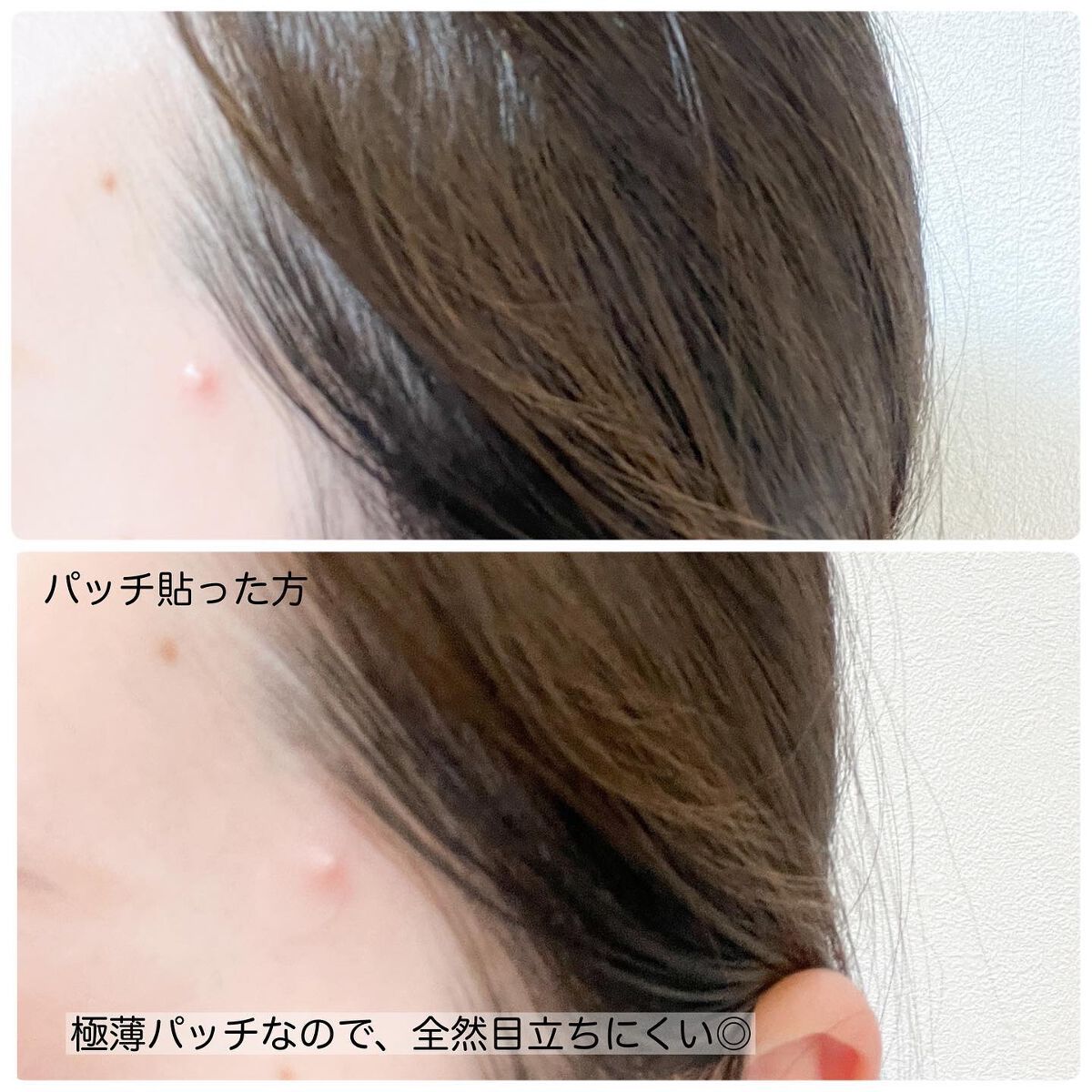 ごめんね素肌 キニナルマスク/クリアターン/シートマスク・パックを使ったクチコミ(4枚目)