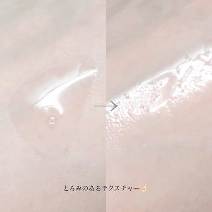 ティーツリーシカスージングトナー/BRING GREEN/化粧水を使ったクチコミ(5枚目)