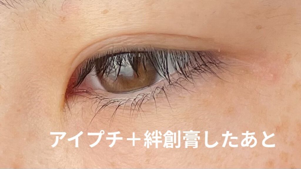 絆創膏/DAISO/その他を使ったクチコミ（2枚目）