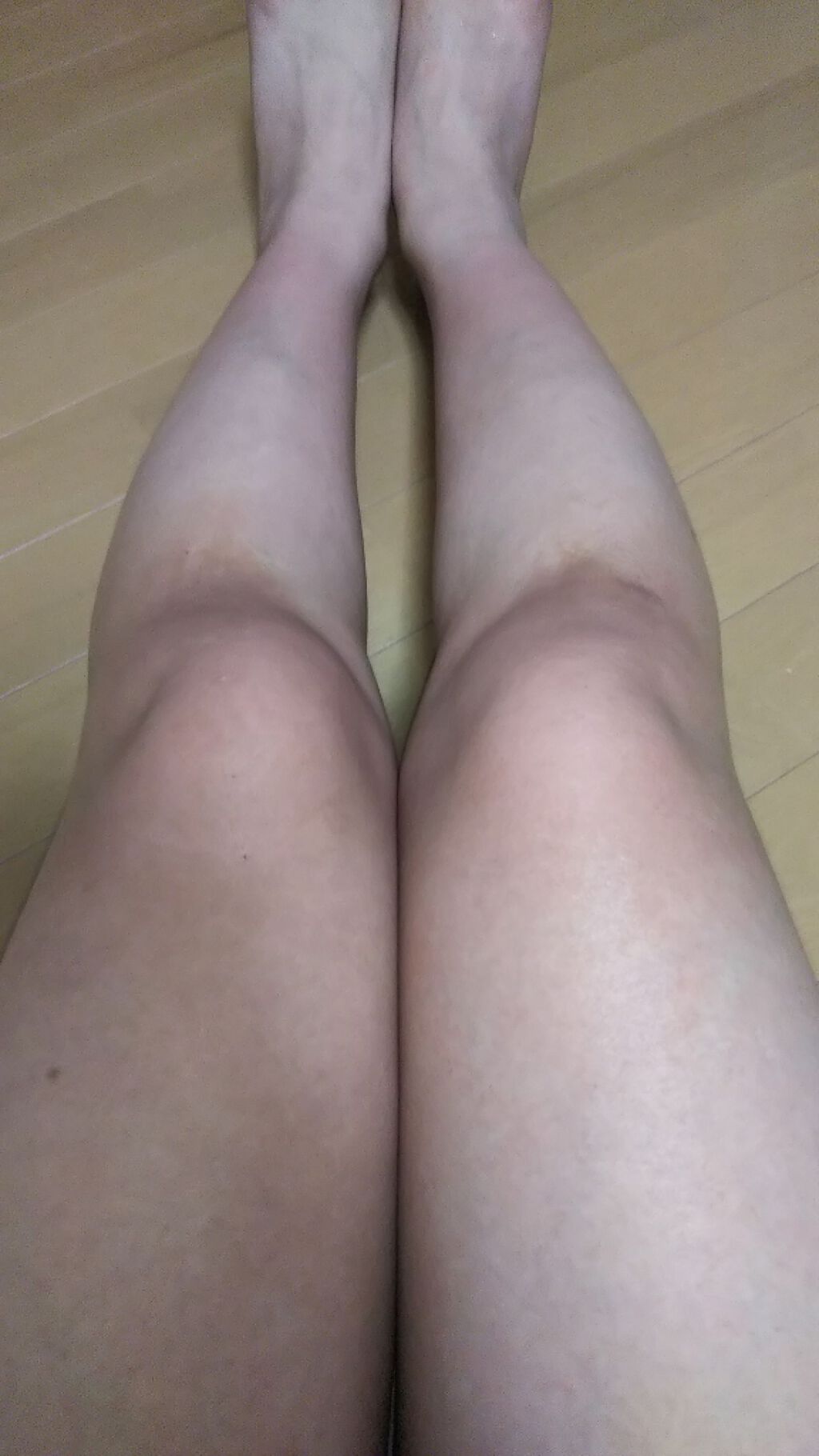 除毛クリーム シトラスホワイトリリィ/スリンキータッチ セルフスパ/除毛クリームを使ったクチコミ（3枚目）