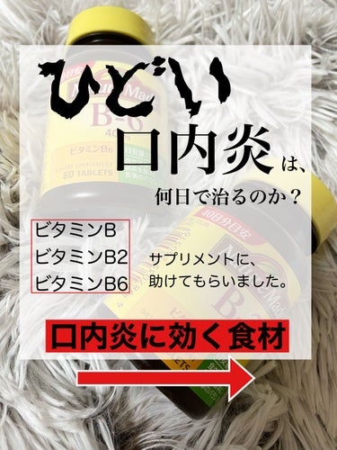 ネイチャーメイド ビタミンB2のクチコミ「前回のひどい口内炎についての、ビタミンサプリレビューから３日経ちました‼️


人生で1位2位.....」（1枚目）