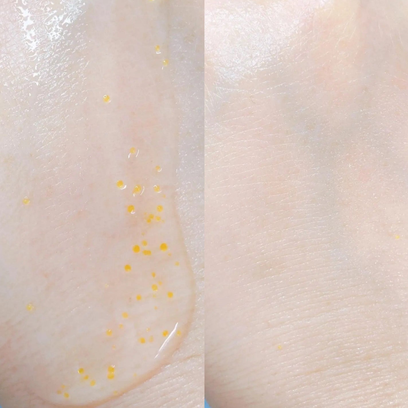 デイリーバイタライズカプセルセラム/SAM'U/美容液を使ったクチコミ(4枚目)