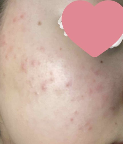 を使ったクチコミ(3枚目)