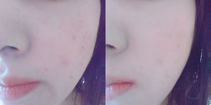 ã·ã³ã¯ããã£ãã ãã¯ã UV/ESPRIQUE/ããŠããŒãã¡ã³ããŒã·ã§ã³ã䜿ã£ãã¯ãã³ãïŒ4æç®ïŒ