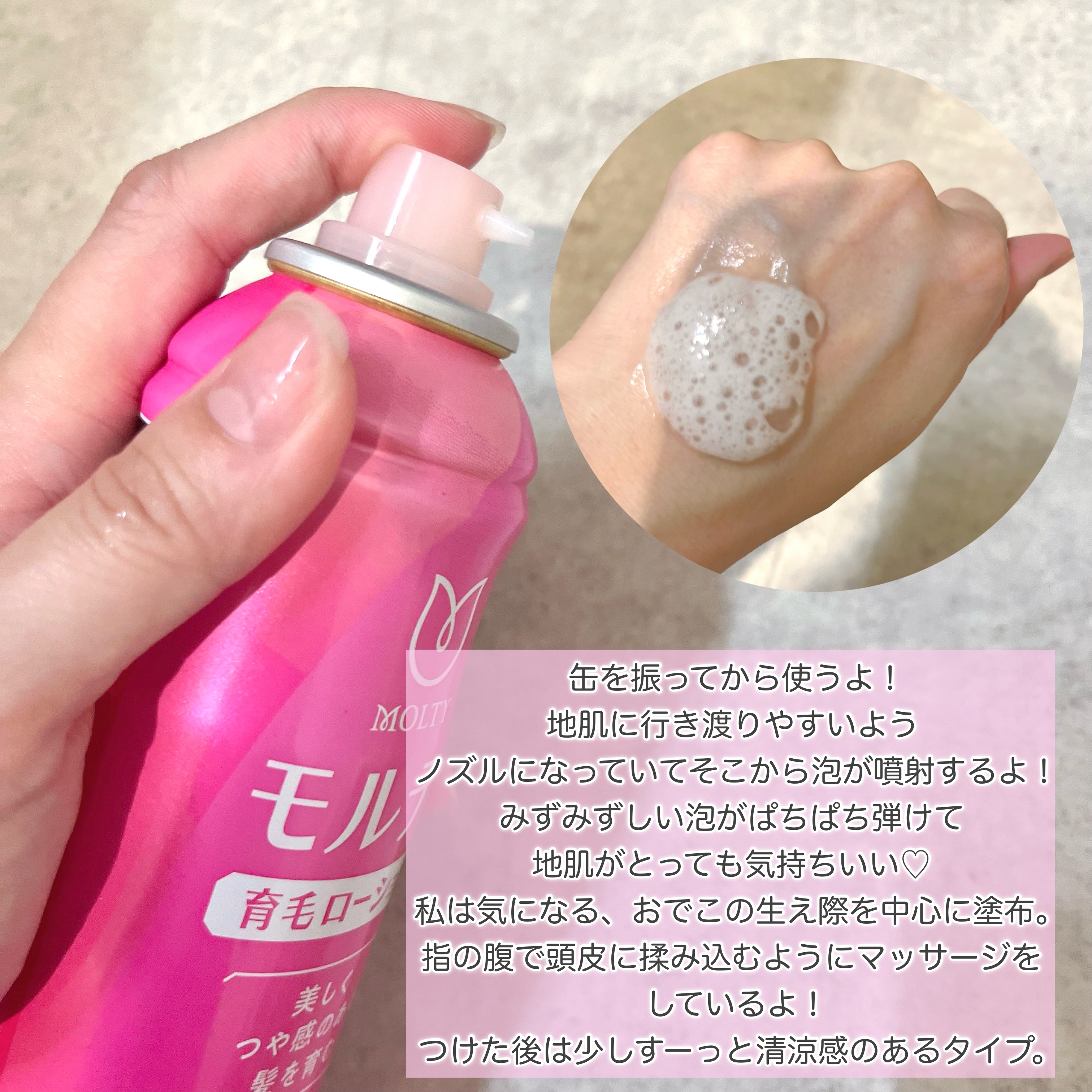 モルティ 薬用育毛ローション/モウガL/頭皮ローションを使ったクチコミ（2枚目）