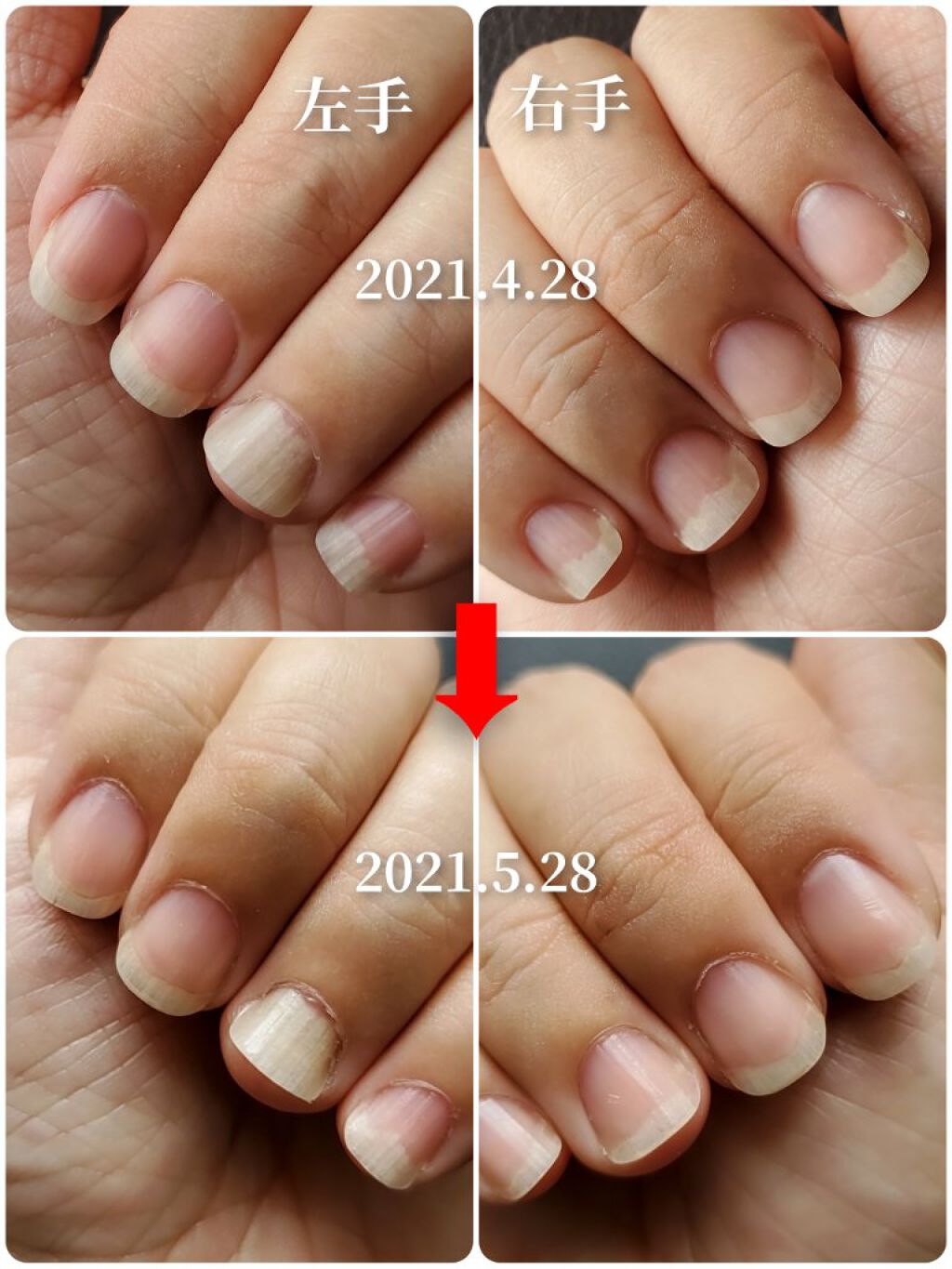 エテュセ クイックケアコート/ettusais/ネイルオイル・トリートメントを使ったクチコミ（3枚目）