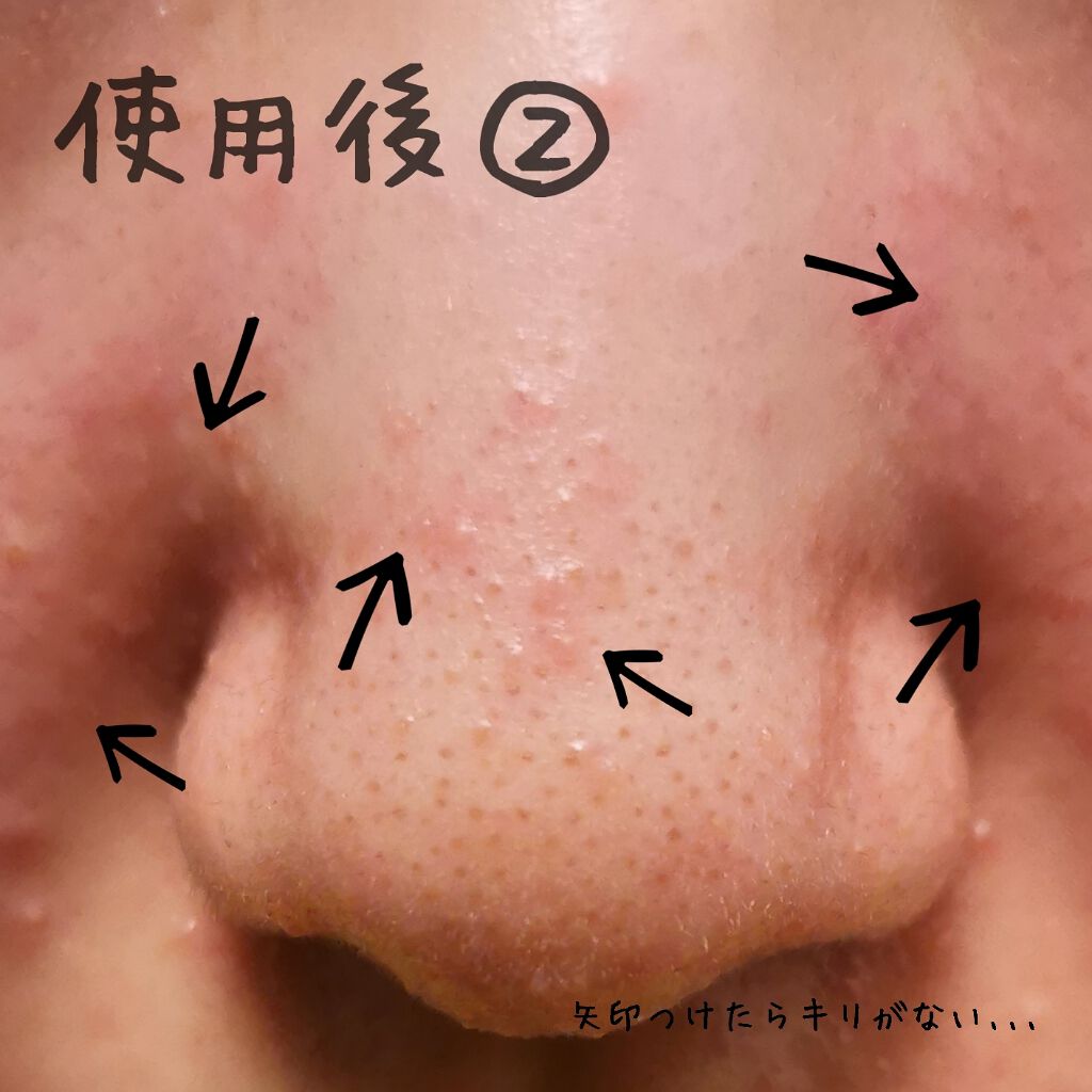 ベビーオイル ナチュラル/DAISO/ボディオイルを使ったクチコミ(3枚目)