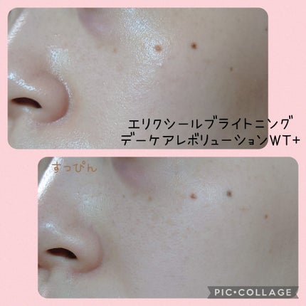 ブライトニング デーケアレボリューション WT+/エリクシール/乳液を使ったクチコミ(2枚目)