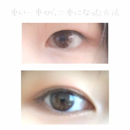 アイビューティー フィクサー WP/アストレア ヴィルゴ/二重まぶた用アイテムを使ったクチコミ(1枚目)