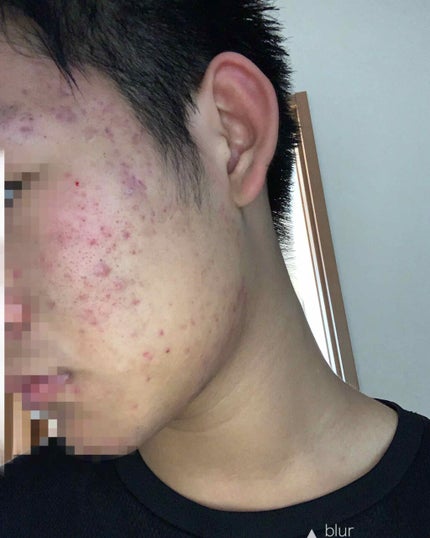 é«2ç·åðŠð» on LIPS ããããã«æ©ãã§4幎ã»ã©ããå人ãããèèãããããããšãèšãã..ãïŒ2æç®ïŒ