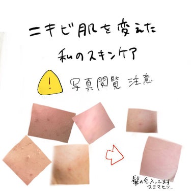 乳液・敏感肌用・さっぱりタイプ/無印良品/乳液を使ったクチコミ（1枚目）