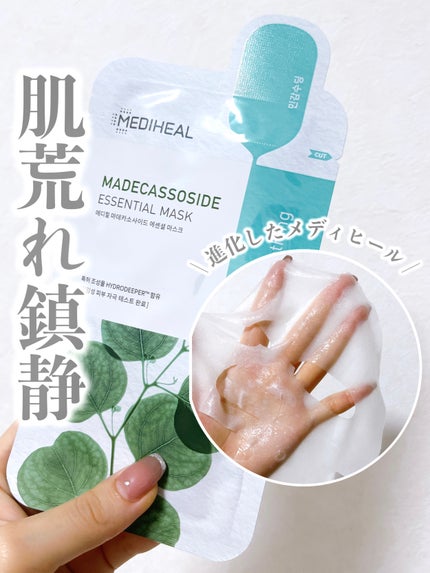 マデカソサイドエッセンシャルマスク/MEDIHEAL/シートマスク・パックを使ったクチコミ(1枚目)