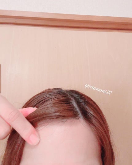 オデコディープパッチ/北の快適工房/シートマスク・パックを使ったクチコミ(6枚目)