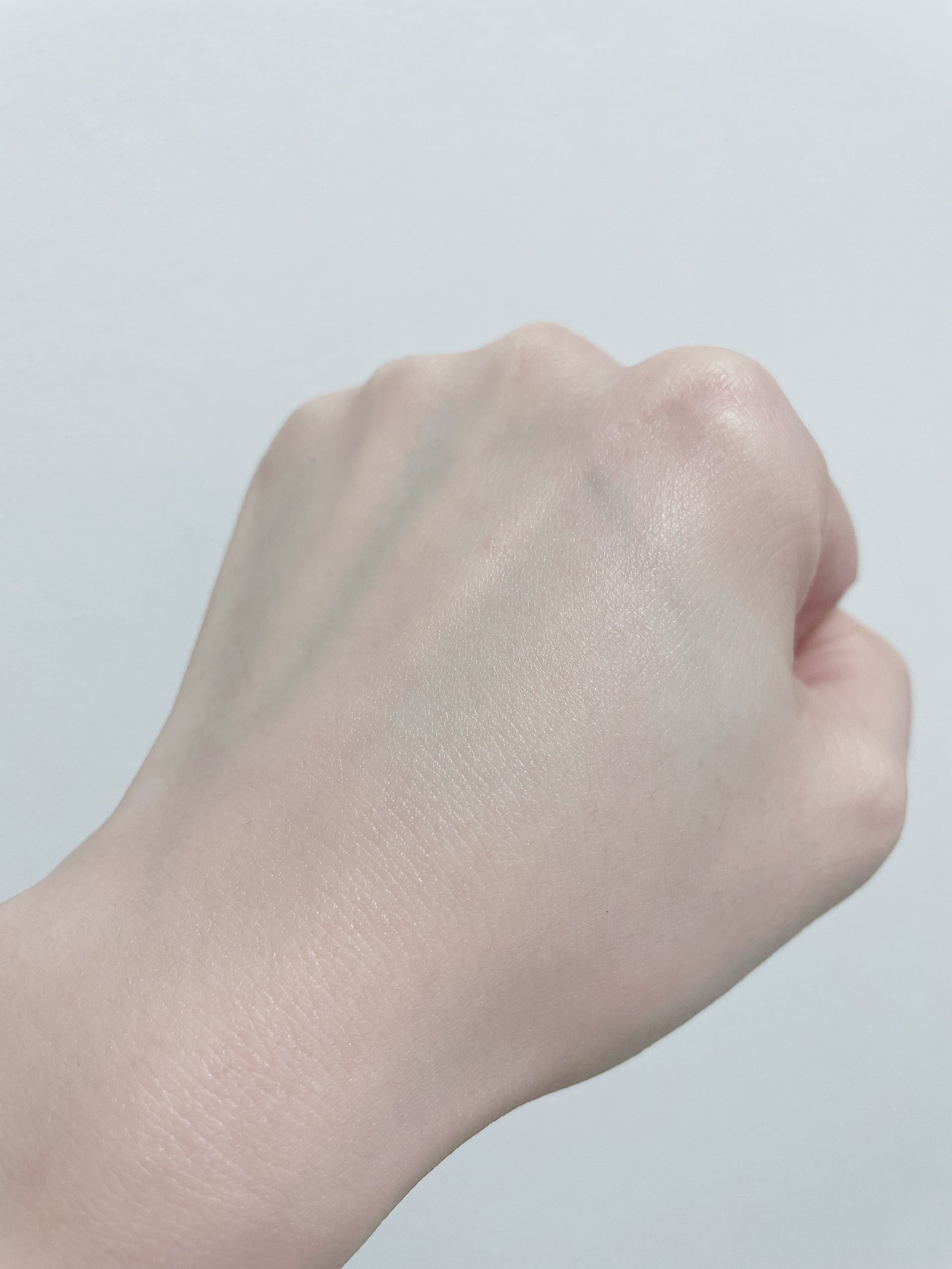 サイエンシューティカルズアンプル /PHYSIOGEL/美容液を使ったクチコミ(3枚目)