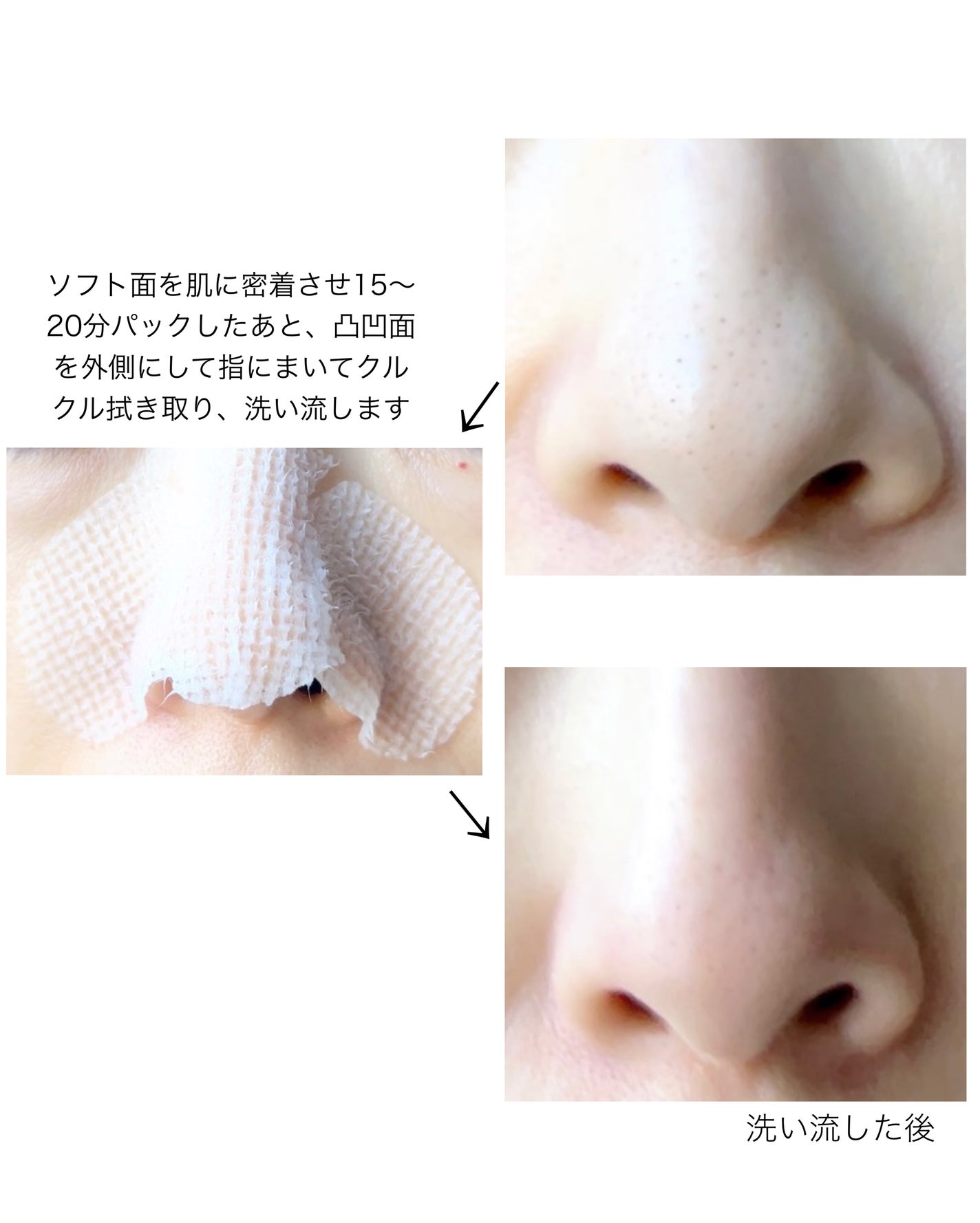 ノーモアブラックヘッド(ノーズピーリング)/One-day's you/スクラブ・ゴマージュを使ったクチコミ(7枚目)