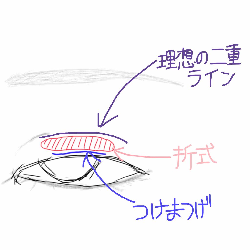 【旧品】オリシキ アイリッドスキンフィルム/D-UP/二重まぶた用アイテムを使ったクチコミ（2枚目）