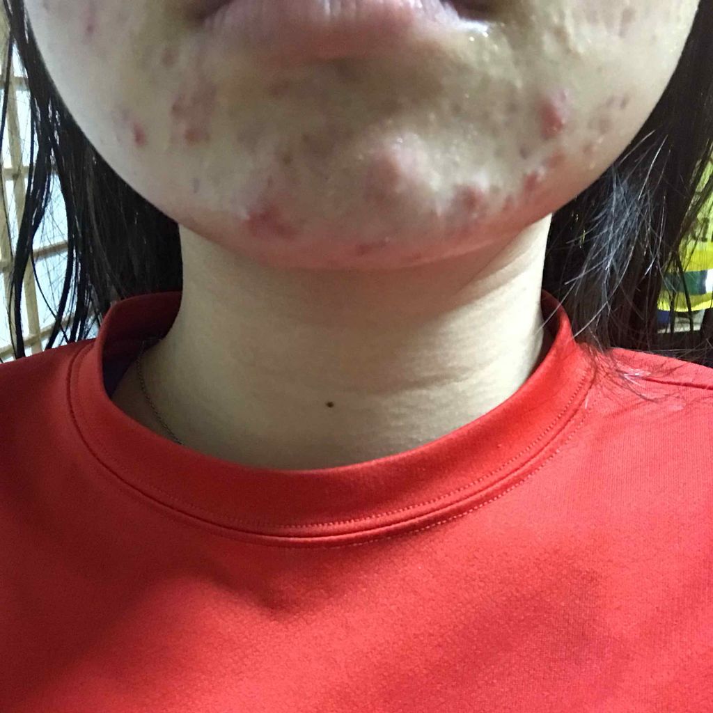 ポム on LIPS 「こんばんは。新高三になりますポムです。実は、中2の頃からずっと..」(4枚目)