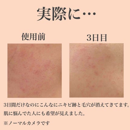 ホホバオイル/無印良品/ボディオイルを使ったクチコミ(4枚目)